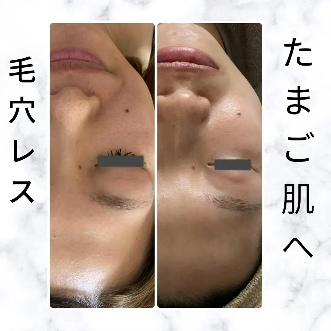 エステ 肌質再生 〜イア🌺リイ〜のエステ・リラクイメージ