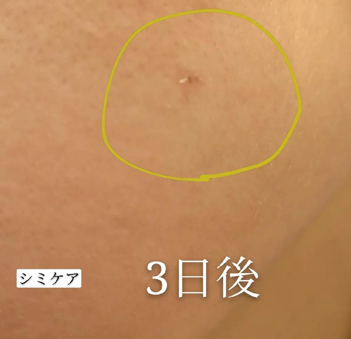 🅖🅤🅩🅔🅛 salonのエステ・リラクイメージ