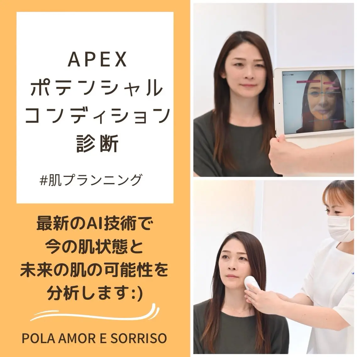 最新AI診断による肌分析の写真
