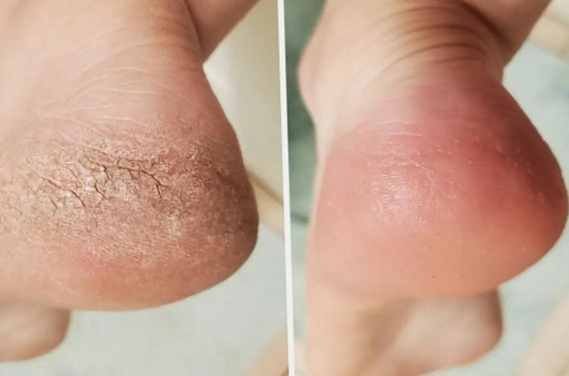 ネイル フットネイル HerNails  Yokosukaのネイルデザイン