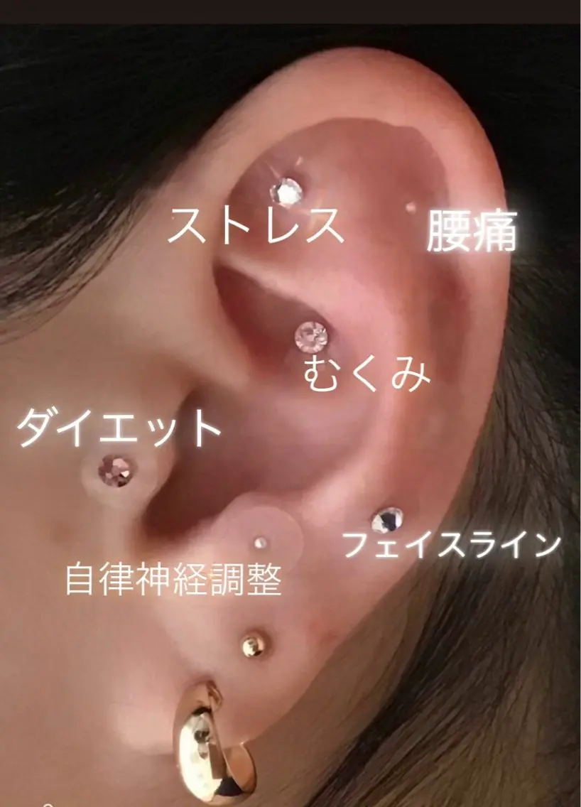 🌼耳つぼジュエリー+クイック美容鍼🌼 ヘッドマッサージ付き 耳つぼ▶︎両耳合わせて14粒の写真