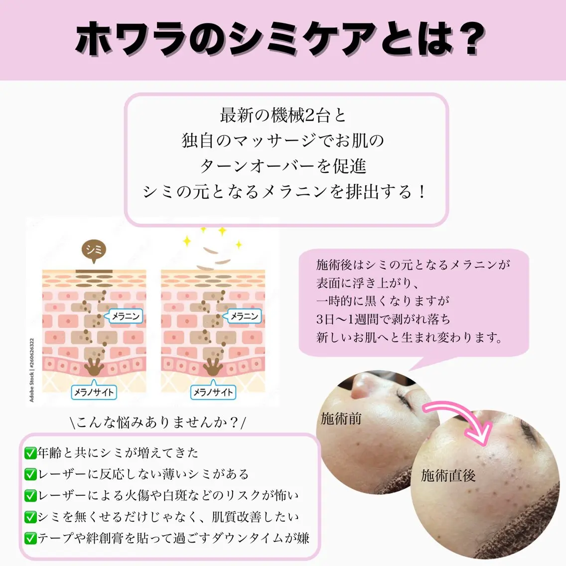 ラフィーユ 豊崎店のその他イメージ