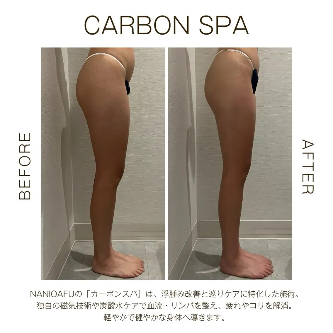 【🌿巡り×むくみ集中ケア】CARBON SPA（上半身or下半身選択）｜温活×深部リリース〈都度払いOK〉の写真