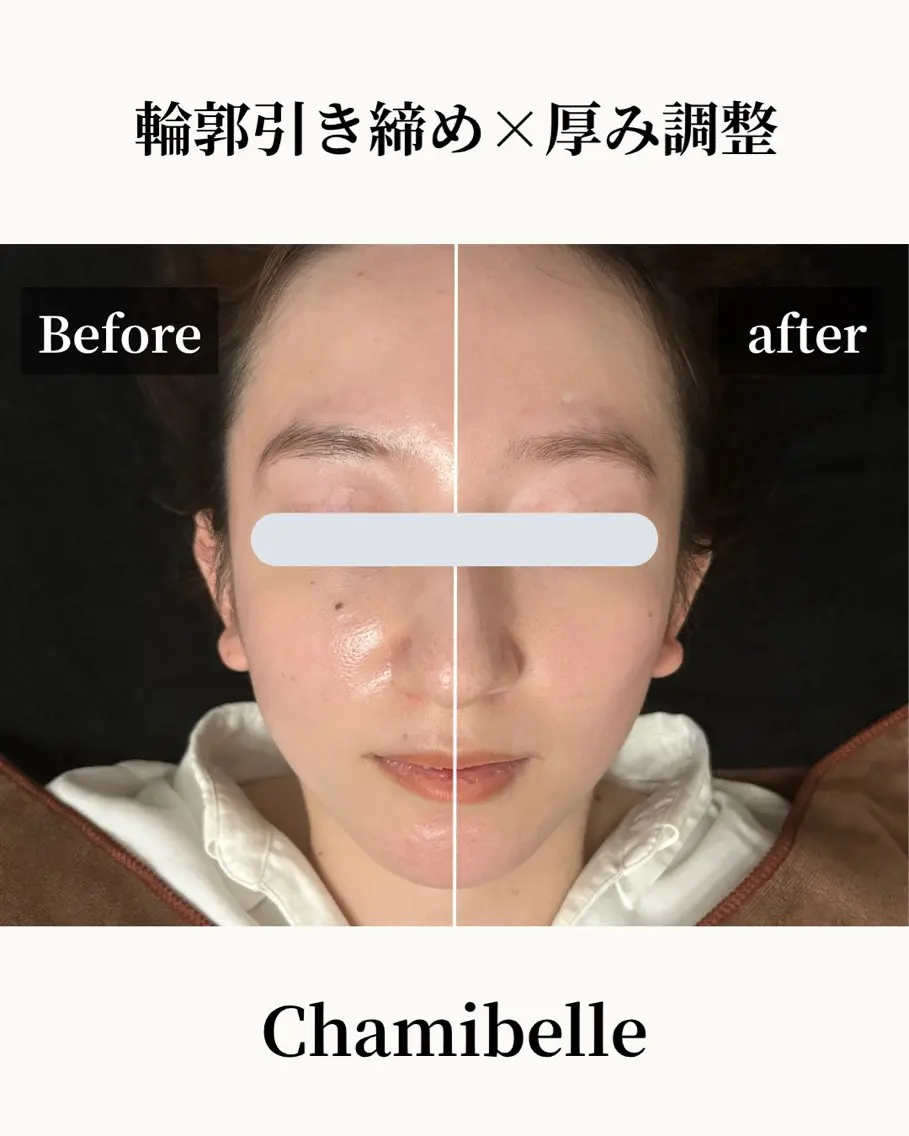 美容鍼灸サロン Chamibelleのエステ・リラクイメージ