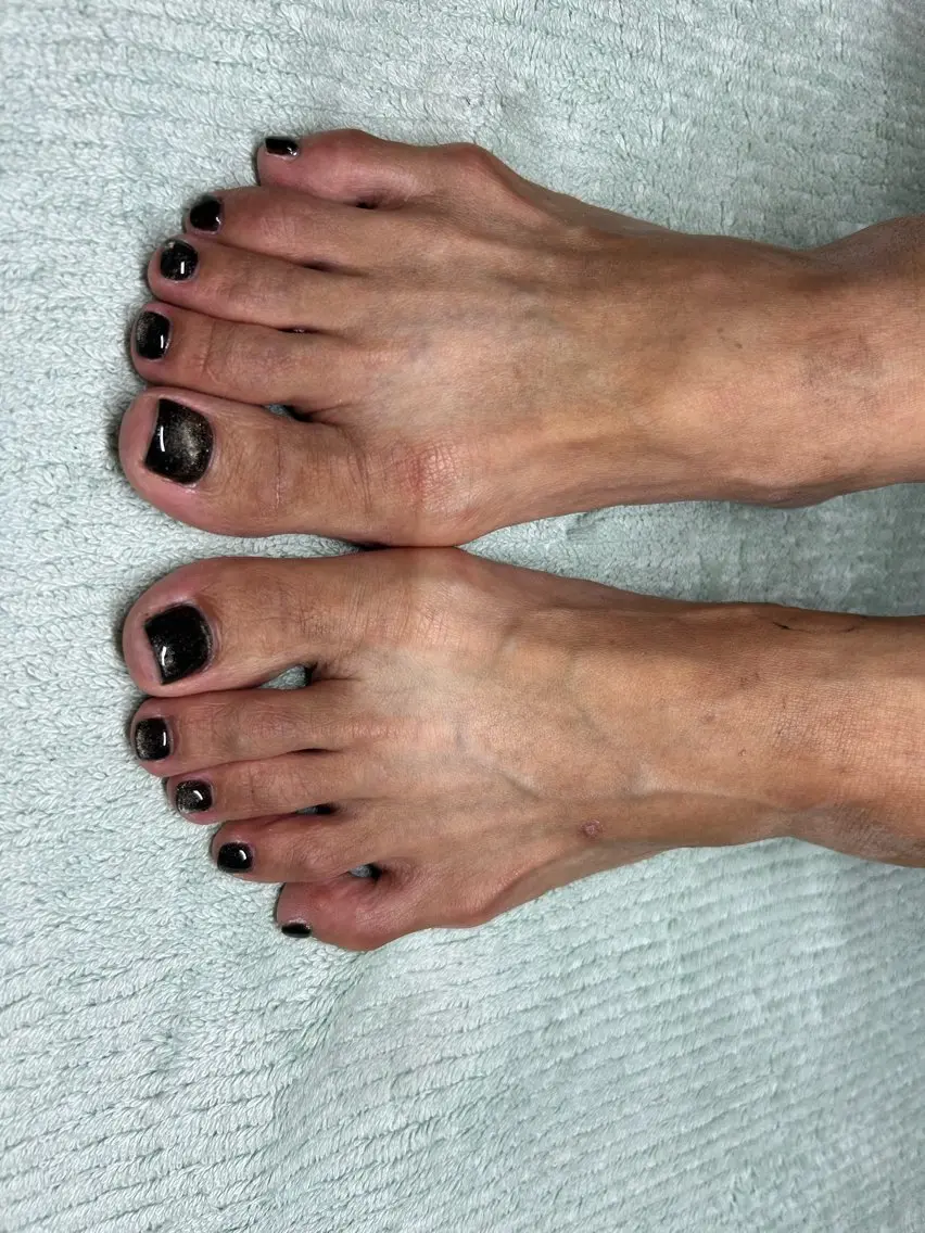 ネイル フットネイル 馬 清君のネイルデザイン