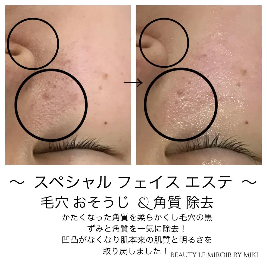ビューティー ミロワールのエステ・リラクイメージ
