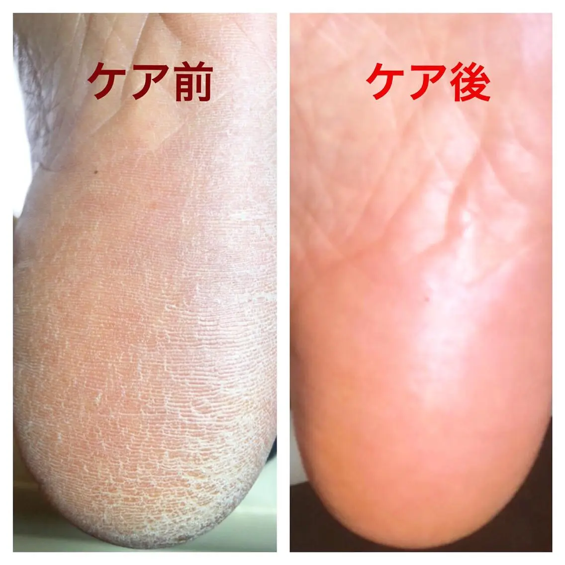 ショート カラー メンズ キッズ ネイル アートネイル フットネイル ジェルネイル 🌱 ま し お 🌱のエステ・リラクイメージ
