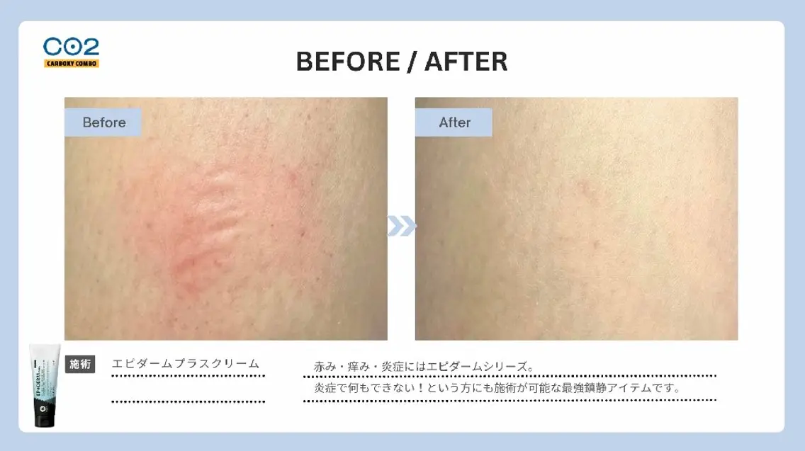 肌質改善 KALANCHOEのエステ・リラクイメージ