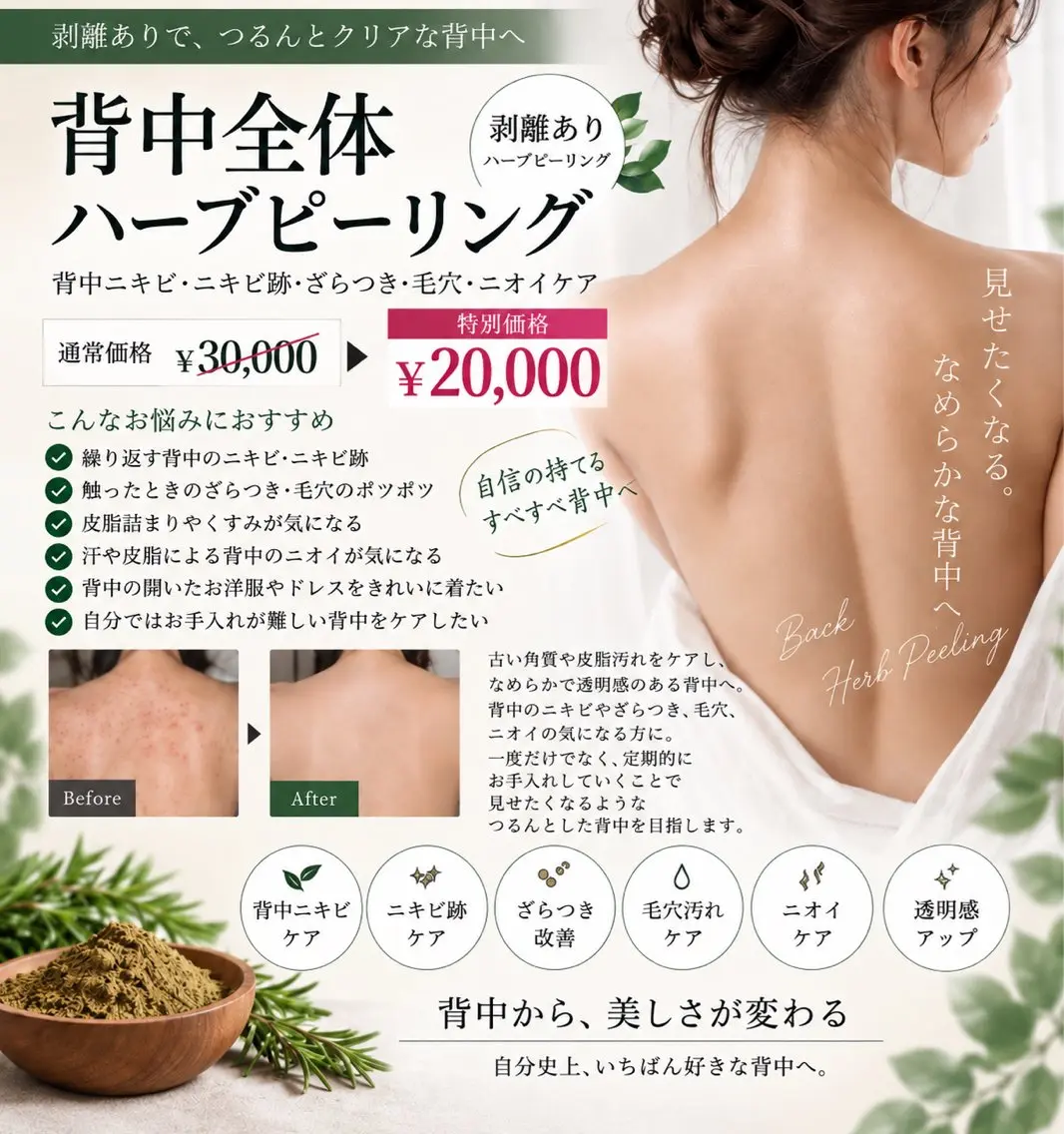 【剥離あり🌿】背中全体ハーブピーリング｜背中ニキビ・ざらつき・毛穴・ニオイケア｜1gの写真
