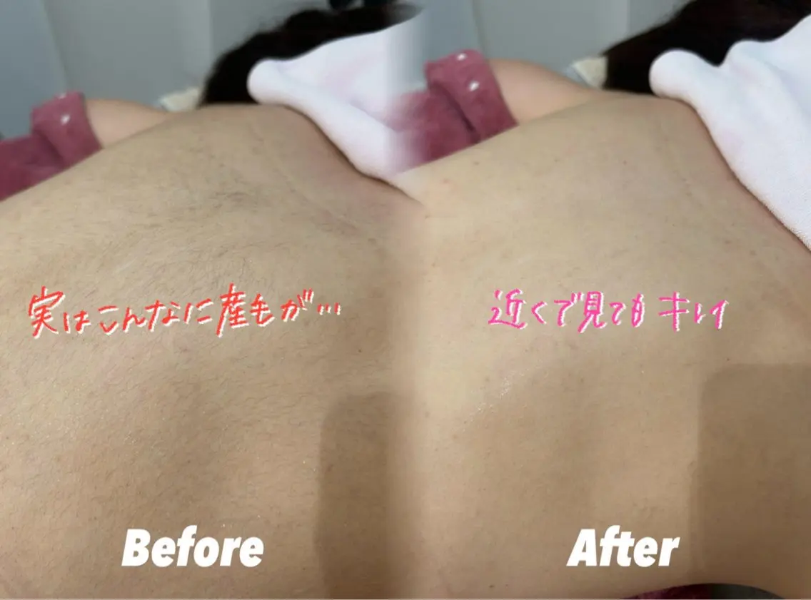 その他 🫧美しい素肌へ🫧 今成柚乃のその他イメージ