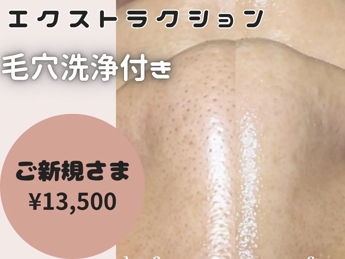エステ 大人女性のための 肌管理サロン　ハピーのエステ・リラクイメージ