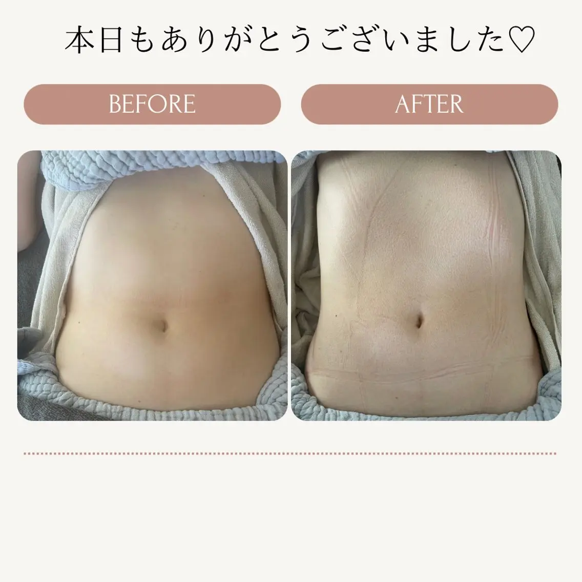 便秘薬なしでスルッと出せる身体への写真