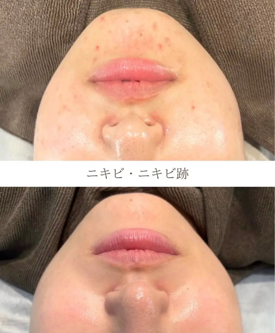 エステ 💎Queen Beauty🫧のエステ・リラクイメージ
