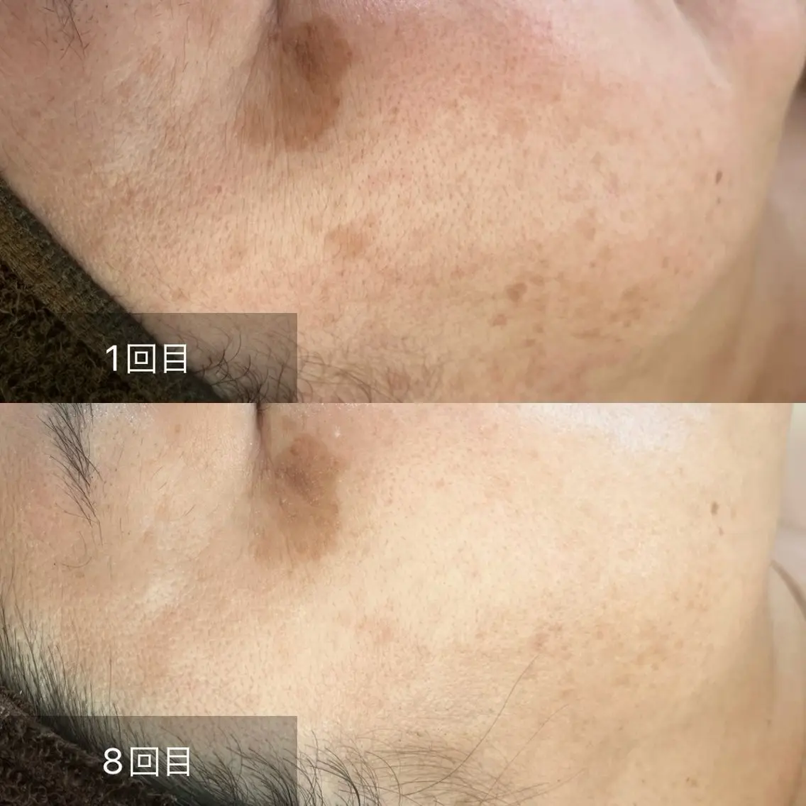 BeautySalo nCielChibaのエステ・リラクイメージ