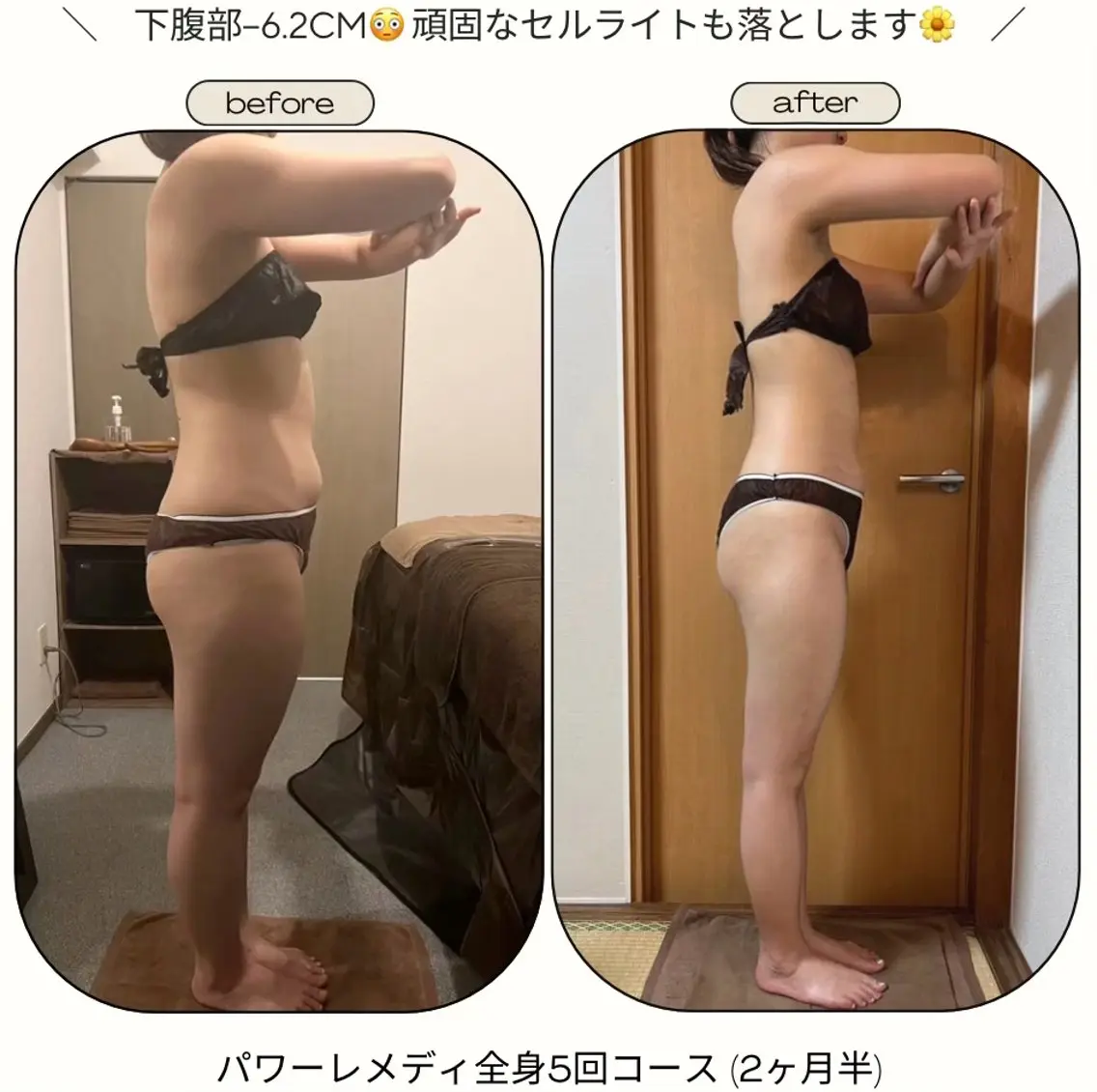 《本気痩せ×疲労改善 》  BILOOPのエステ・リラクイメージ