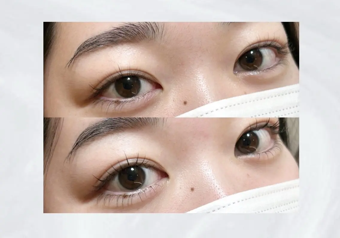 🌟gw限定🌟ぱっちり上下まつげパーマ🎵6/6限定💖トリートメントコーティング付きでツヤツヤEYE🧚の写真