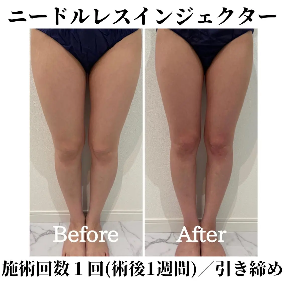 トータルビューティー サロンSalaのマツエク・マツパデザイン