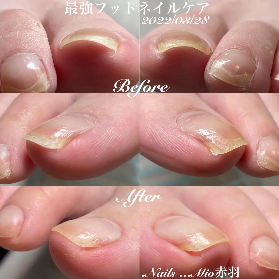 ネイル フットネイル .Nails Mio 赤羽西ネイルサロンのネイルデザイン