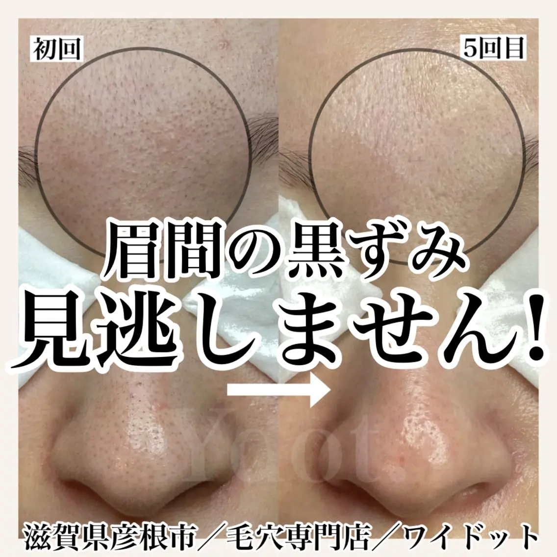 エステ Ydot. 池内 友架のエステ・リラクイメージ