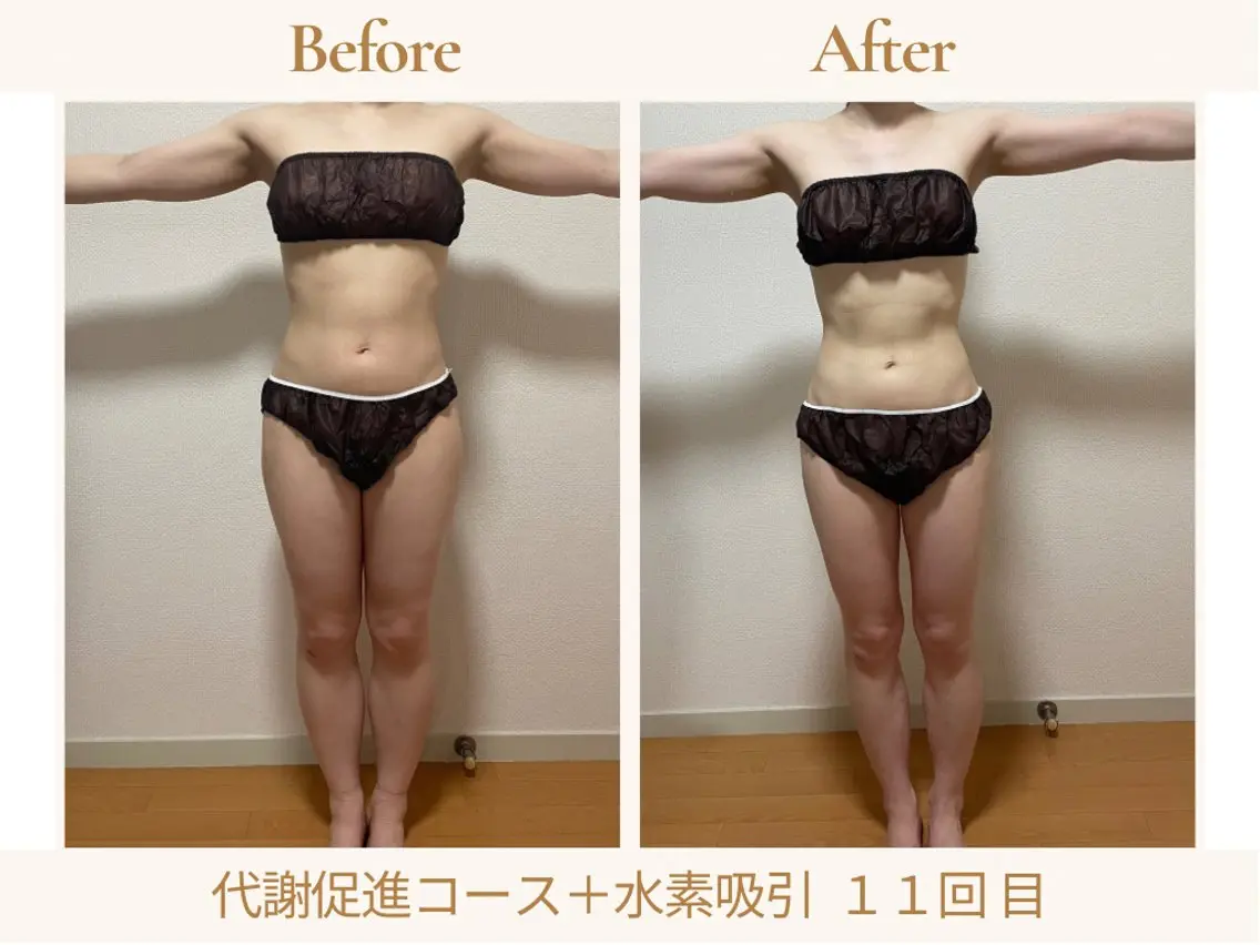 エステ リラク あみ|痩身の最先端 よもぎ蒸しサロン大塚のエステ・リラクイメージ