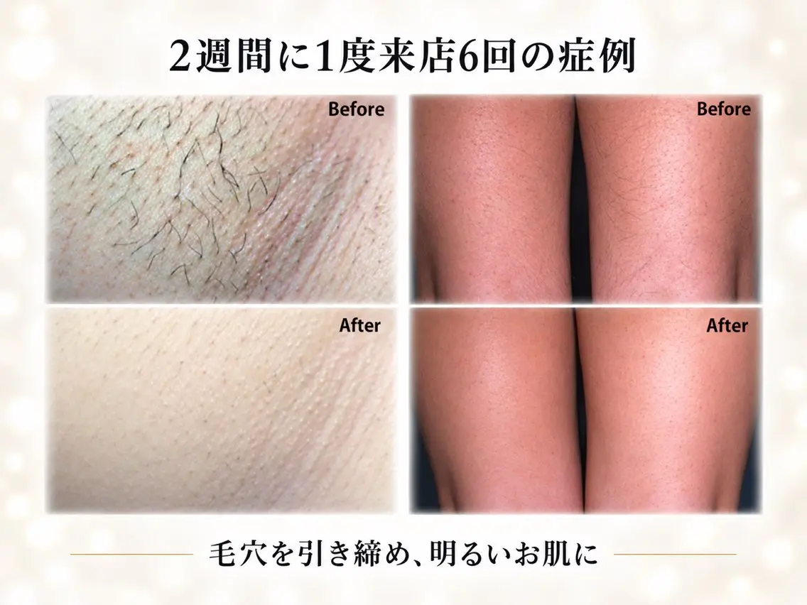 VIKI BEAUTYのエステ・リラクイメージ