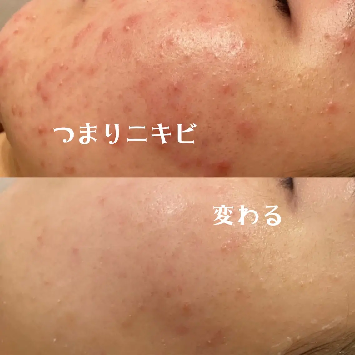 エステ リラク 触れたくなる モテ肌へ...❤︎のエステ・リラクイメージ
