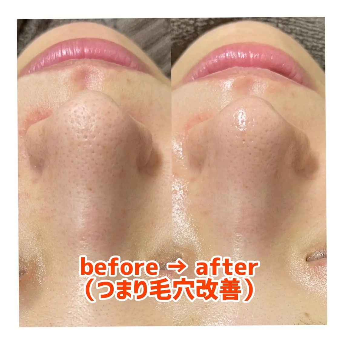 エステ HANA MIKIの眉毛・アイブロウイメージ