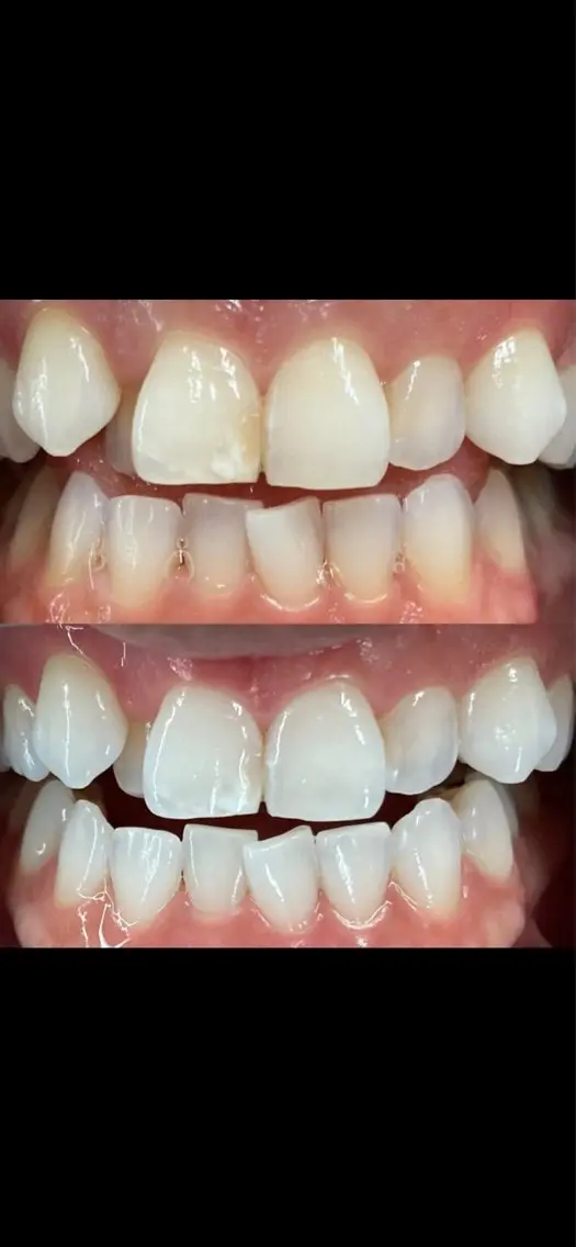 io teeth careのその他イメージ