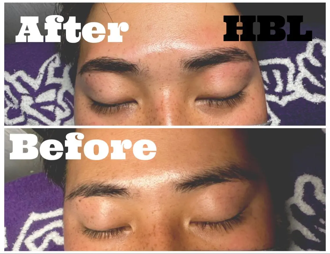 HBLの写真