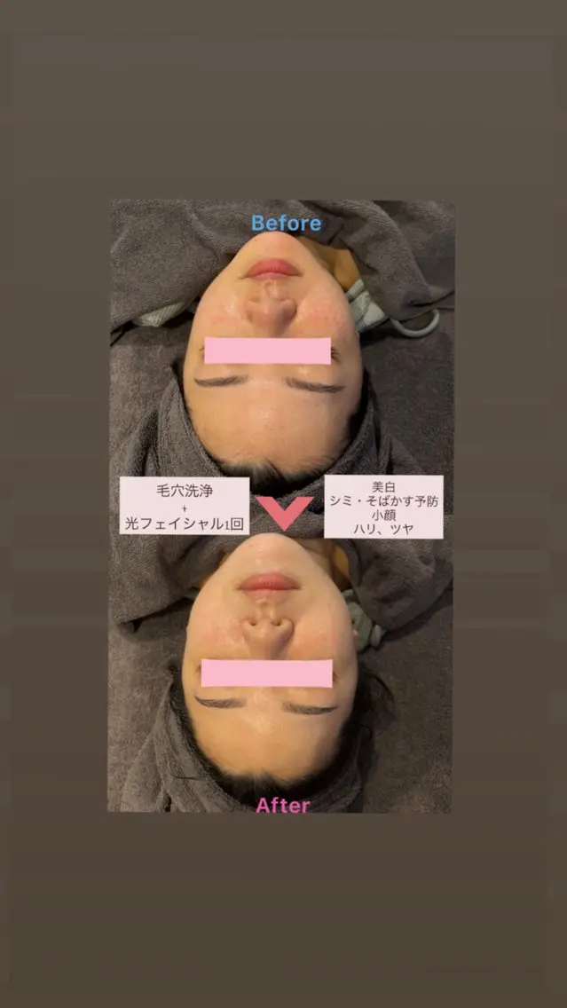 その他 🩷小顔・ 韓国艶肌🩷Mikiのその他イメージ
