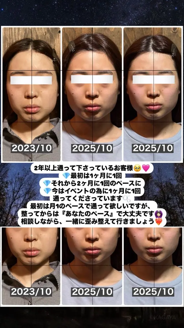 エステ リラク 💎後悔させない小顔 矯正💎イトヤマ🌱のエステ・リラクイメージ