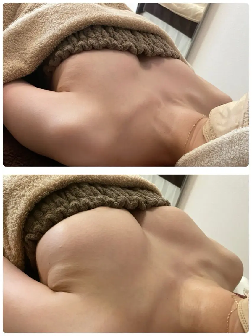 ご新規様限定✨6月末まで平日限定❣️本気の育乳プラン施術80分total120分❣️全身オールハンドでバストアップ⤴️の写真
