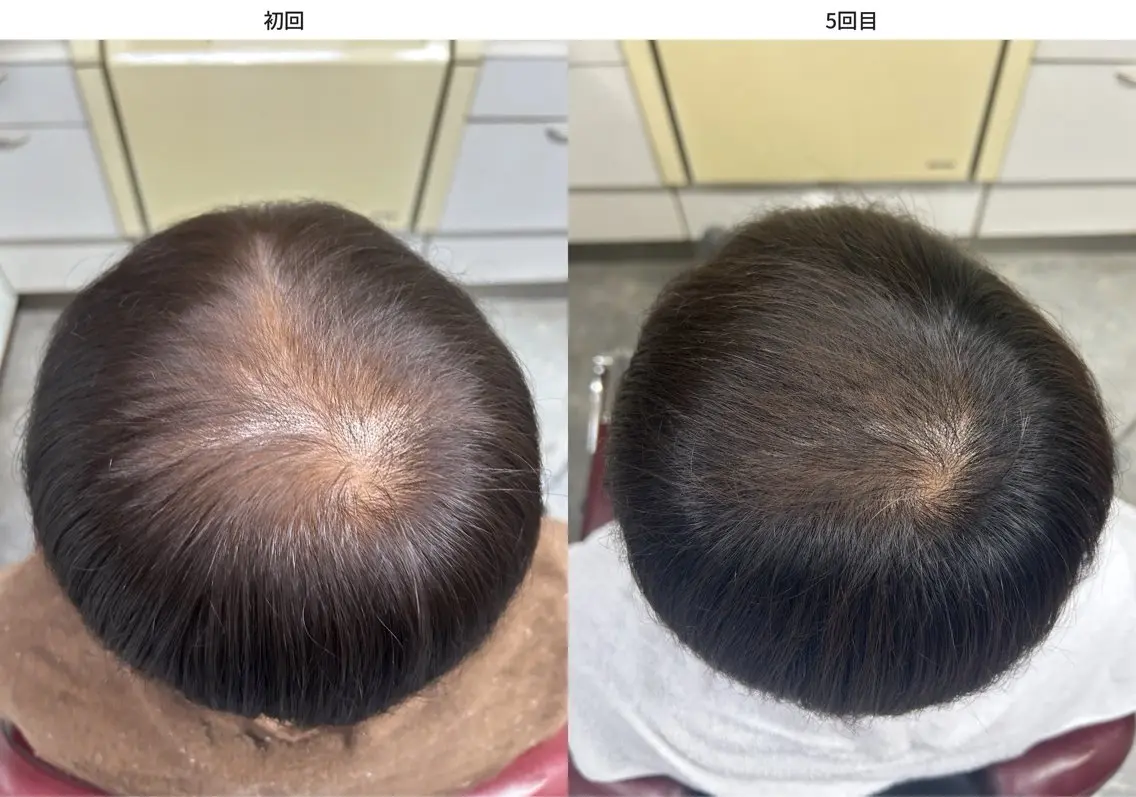 その他 フジイ ケイスケのヘアスタイル