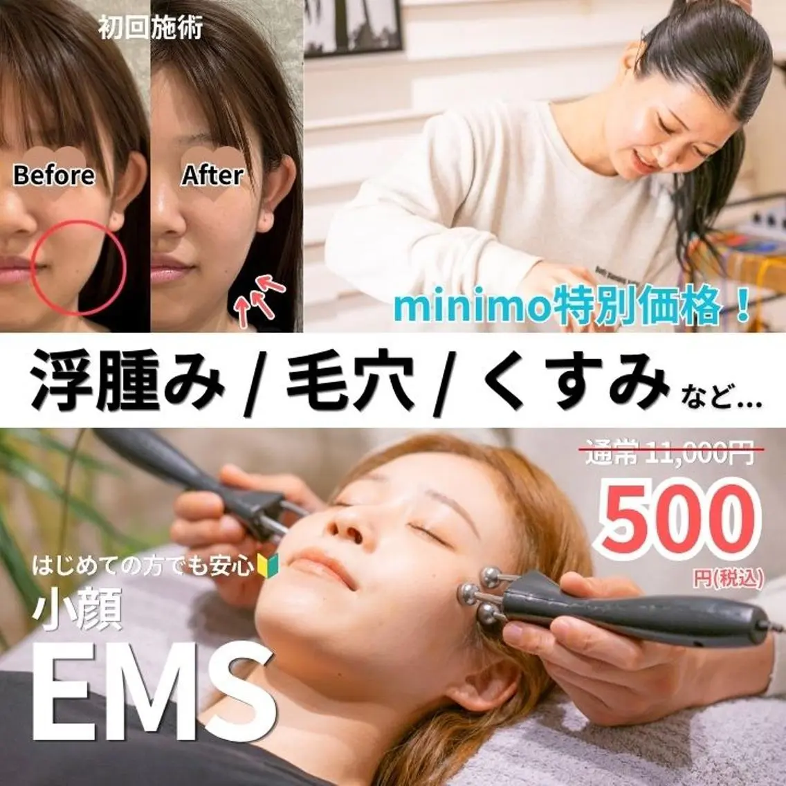 【minimo限定✨500円!!】お顔スッキリ♪小顔EMS+オイルフェイシャル/60分/むくみやフェイスラインをケア🌱の写真