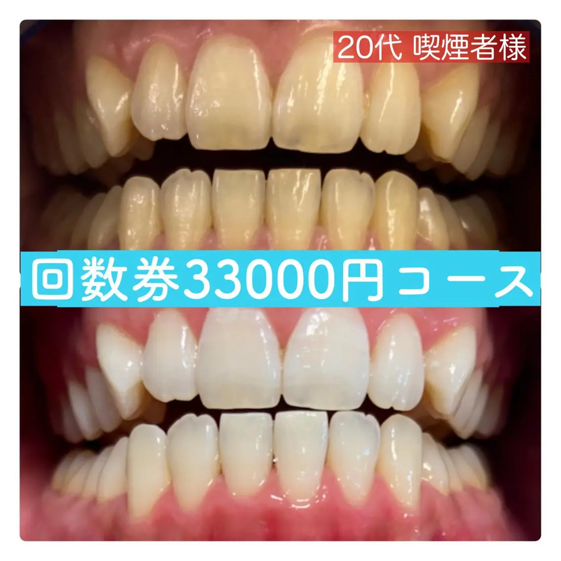 その他 ホワイトニングルーム 横浜店のその他イメージ