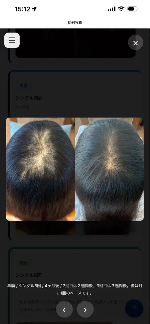 やまもと さやかのネイルデザイン