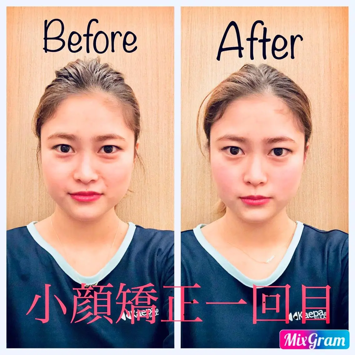初回限定!【頭の位置を整え○○GET!】小顔矯正 60分の写真
