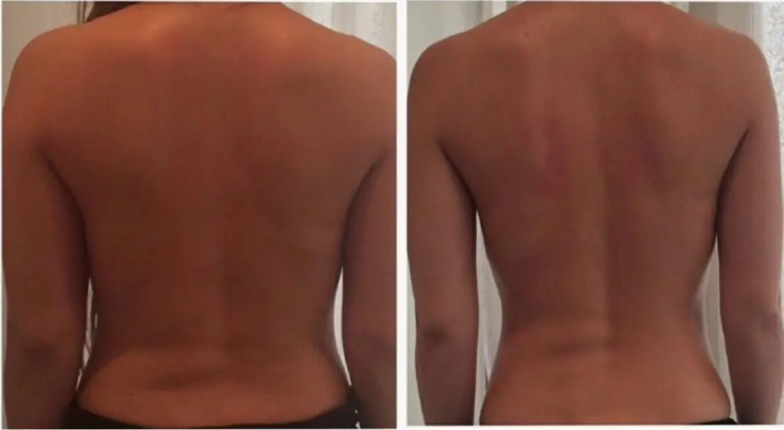 【露出準備OK？】隠してる二の腕背中60分｜痩身エステの写真