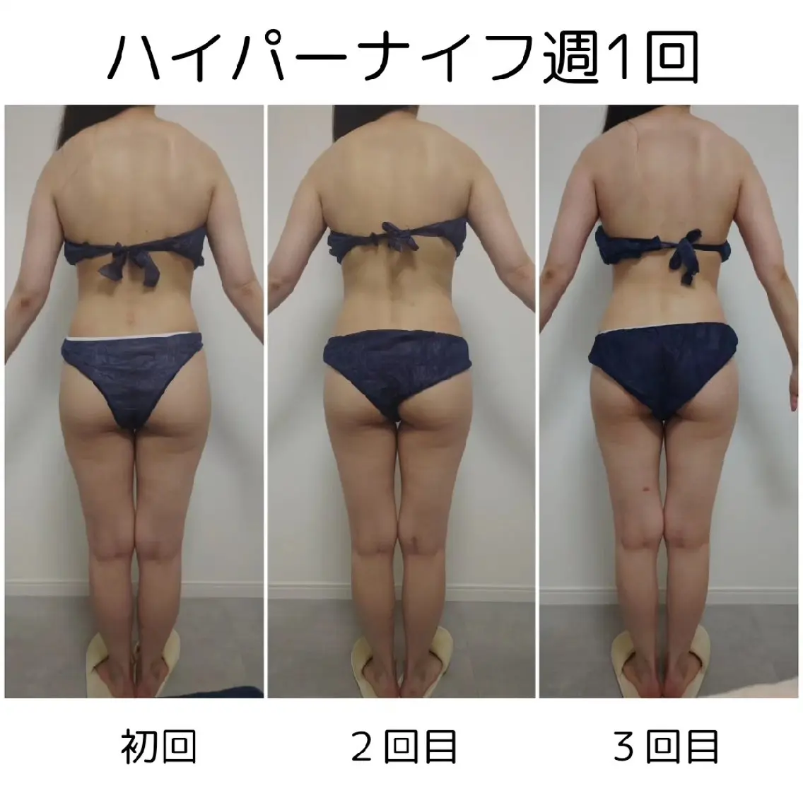 エステ 東洋✖️西洋痩身 TOWA♡関内馬車道のエステ・リラクイメージ