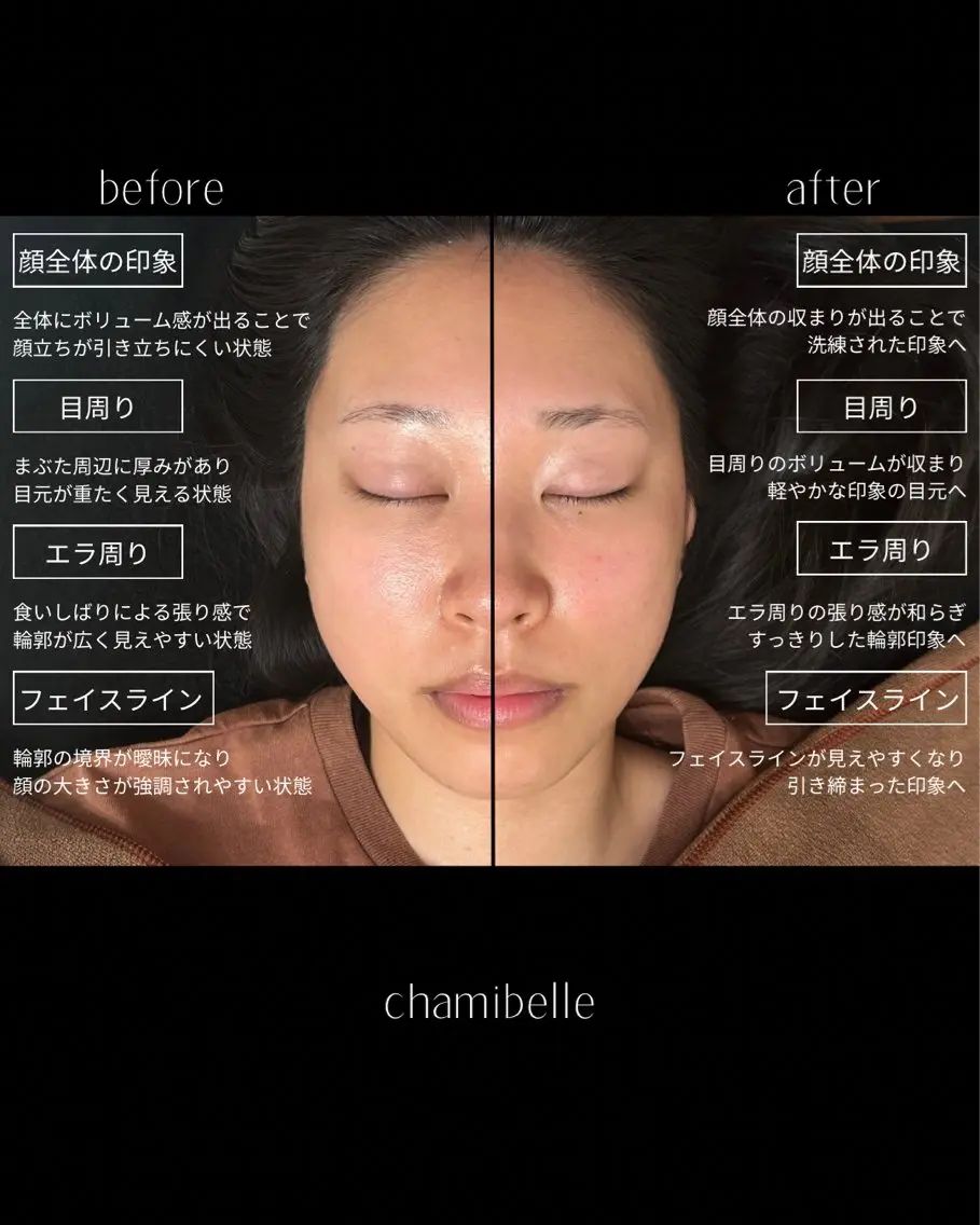 美容鍼灸サロン Chamibelleのエステ・リラクイメージ