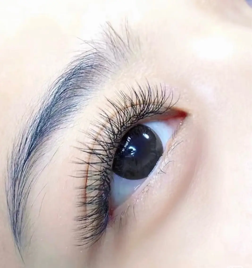 Y型フラッシュ80本の写真