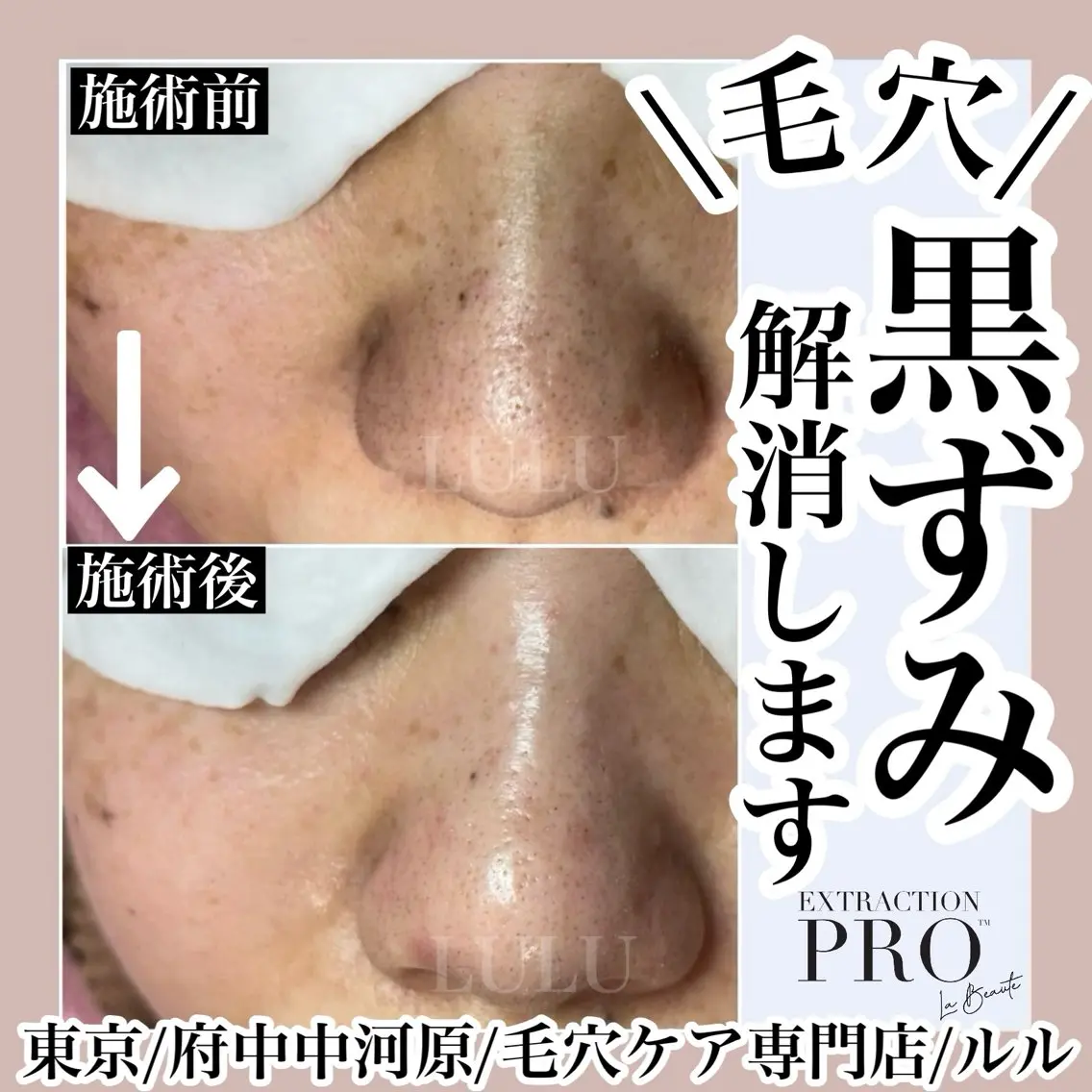 エステ LULU ルルのエステ・リラクイメージ