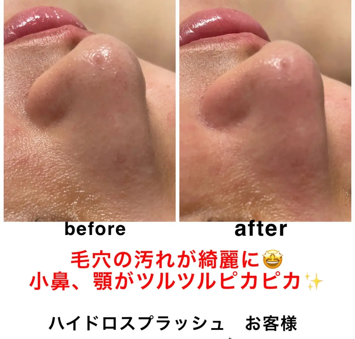 エステ リラク ネイル・エステサロン UILANIのエステ・リラクイメージ