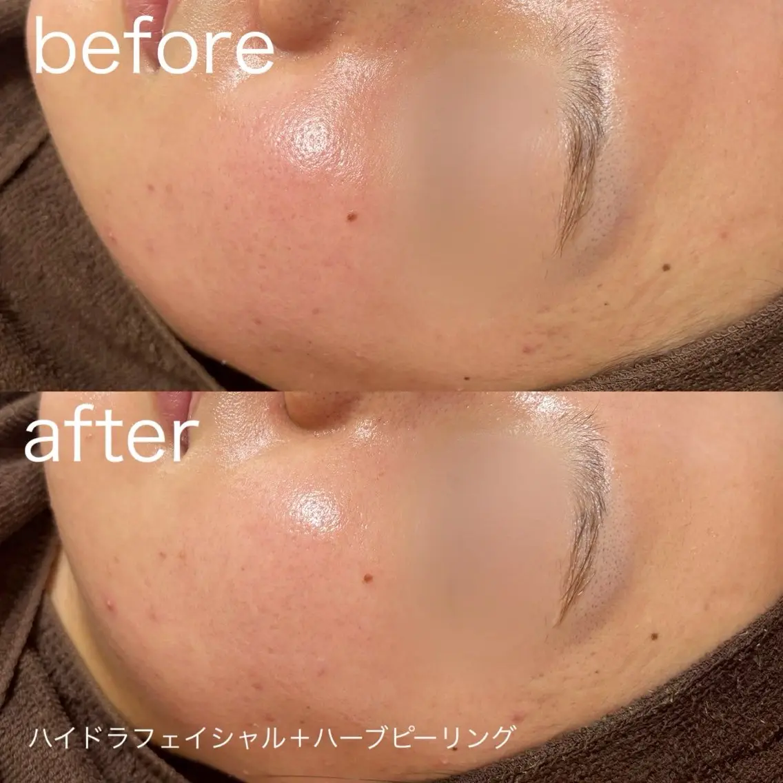 脱毛 lulularico Yuのネイルデザイン
