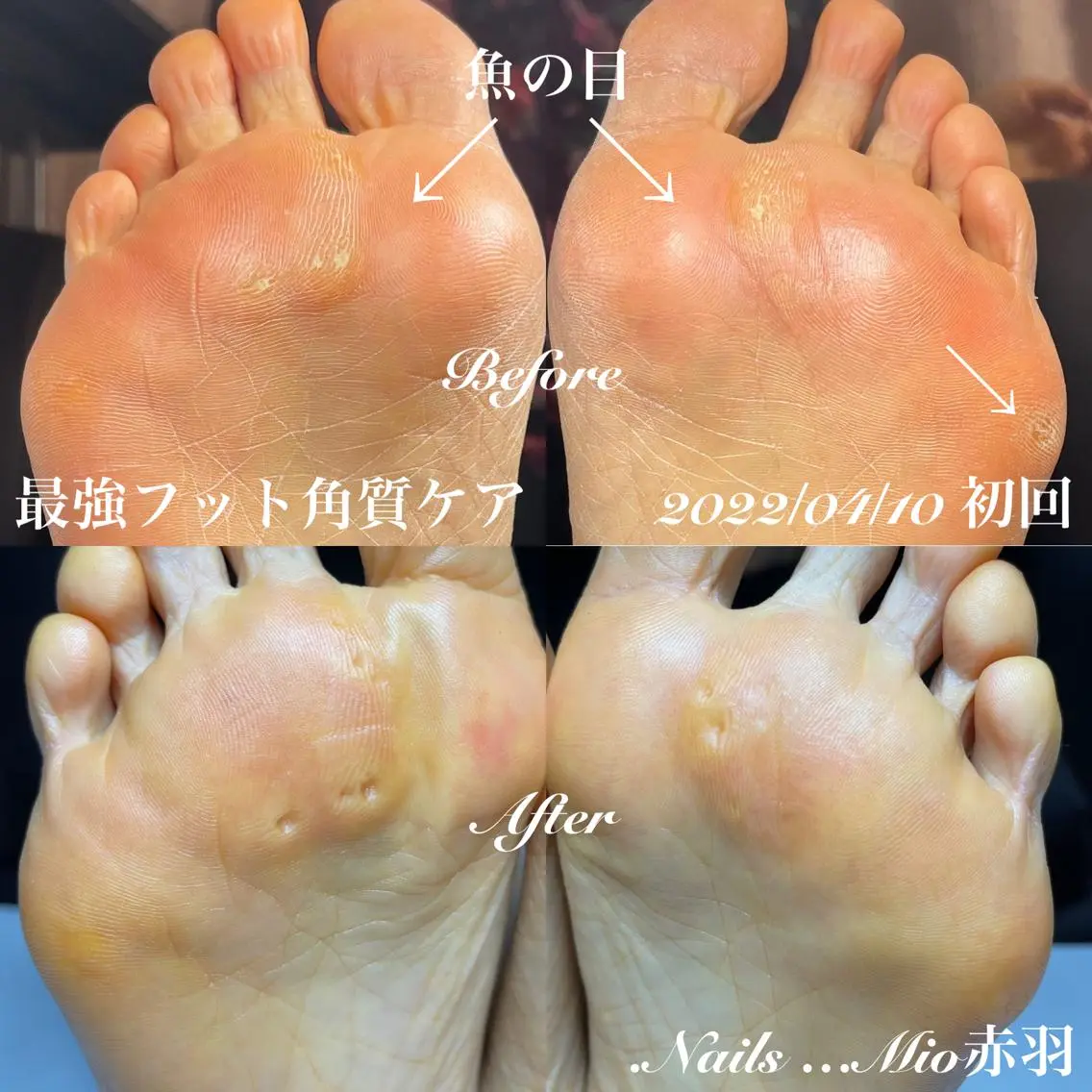 ネイル フットネイル .Nails Mio 赤羽西ネイルサロンのネイルデザイン
