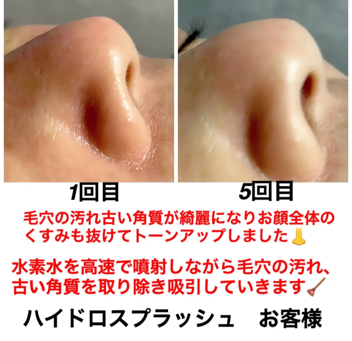 エステ リラク ネイル・エステサロン UILANIのエステ・リラクイメージ