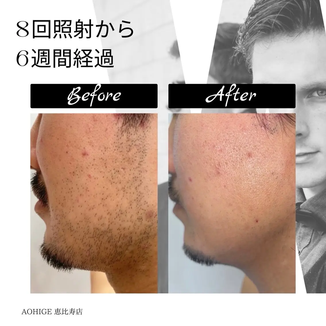 メンズ 脱毛 【ena】 YUKOのマツエク・マツパデザイン