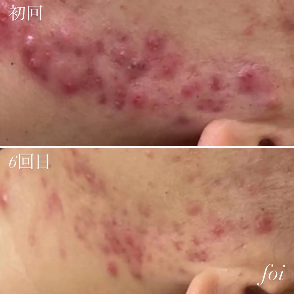エステ 艶肌デトックス🫧 Samiraのエステ・リラクイメージ