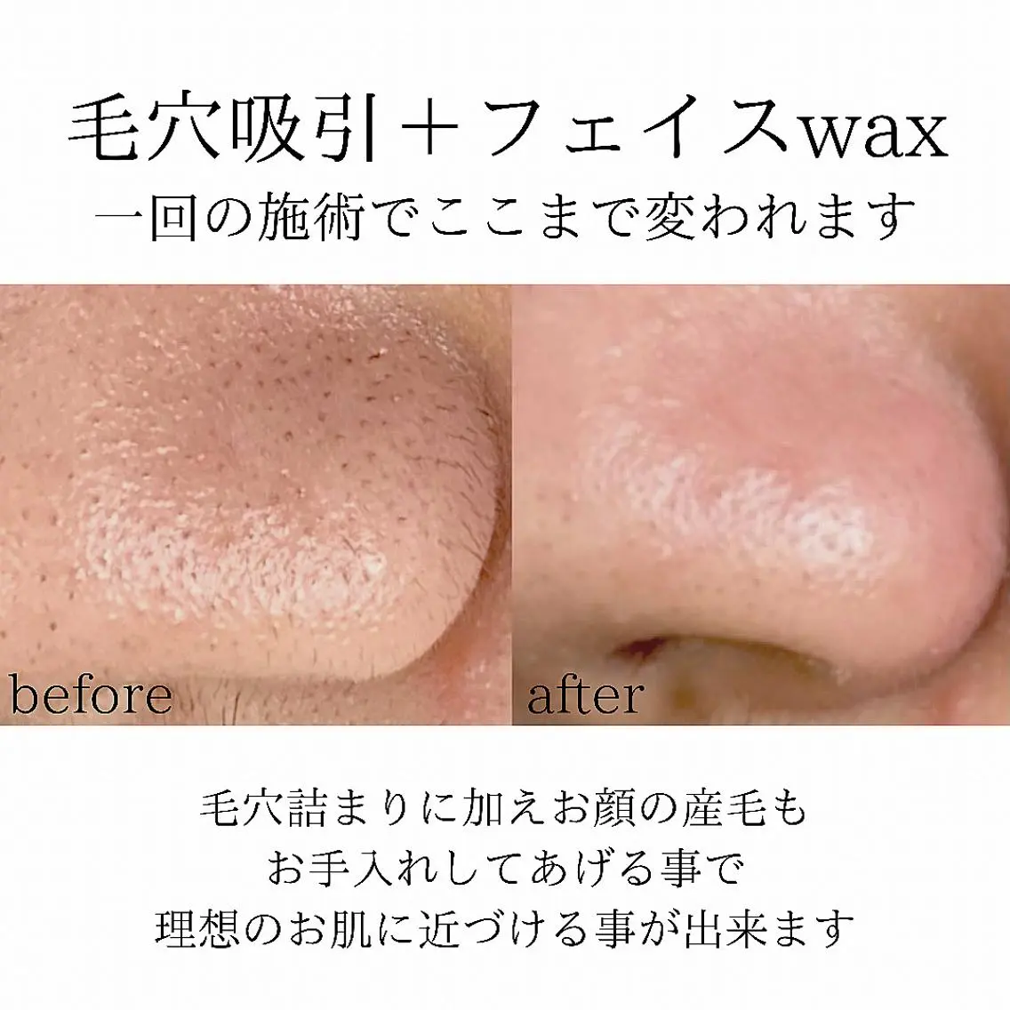 メンズ 脱毛 稲嶺 美華のエステ・リラクイメージ