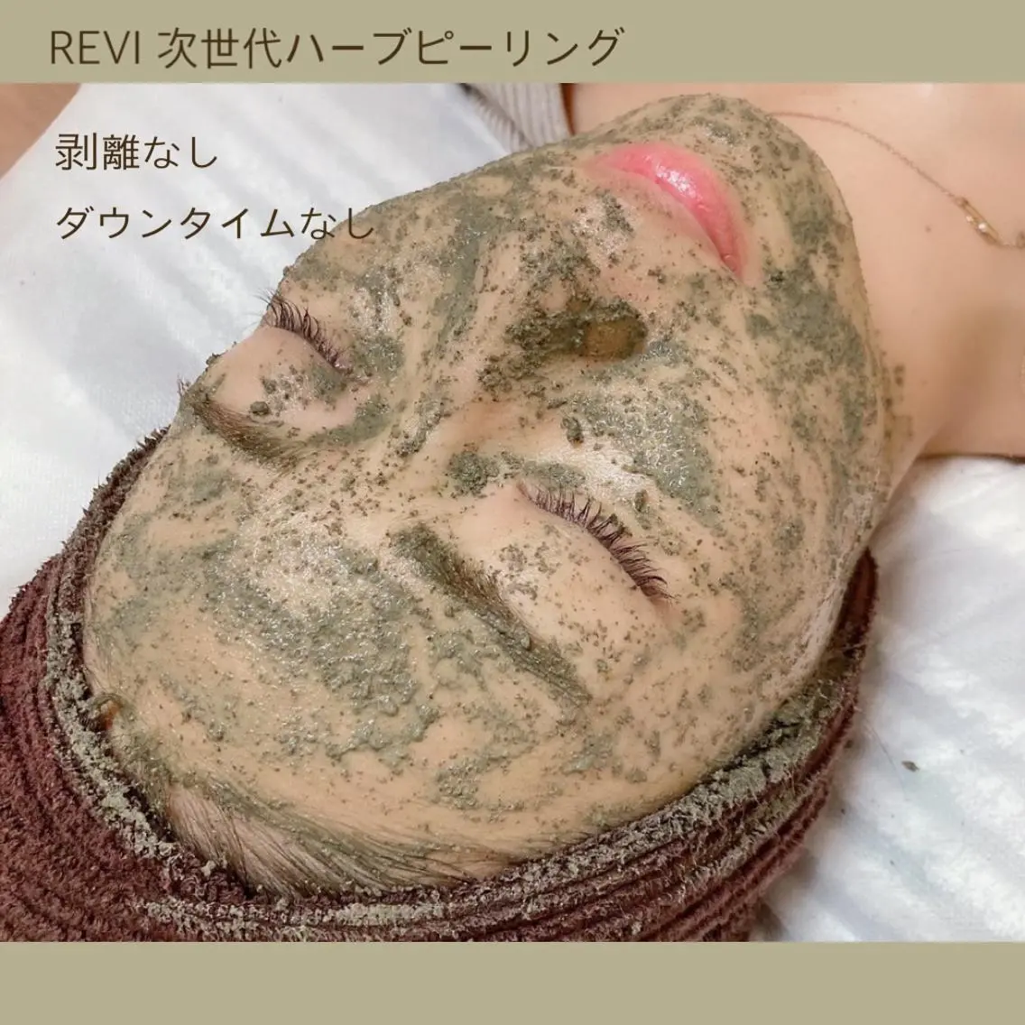 人気No. 1🥇【REVIハーブピーリング】2回で¥11,000❕話題の陶肌トリートメント✨ヘッドマッサージ付♪の写真